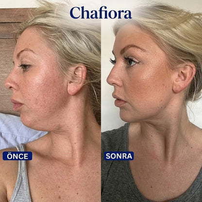 Chafiora Retinol & Kolajen Destekli Çene Altı Maskesi